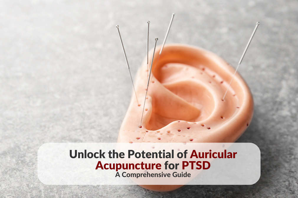 Auricular acupuncture training ear model with needles inserted at specific points, placed on a grey surface, superimposed with the article title 'Unlocking the Potential of Auricular Acupuncture for PTSD Treatment.'