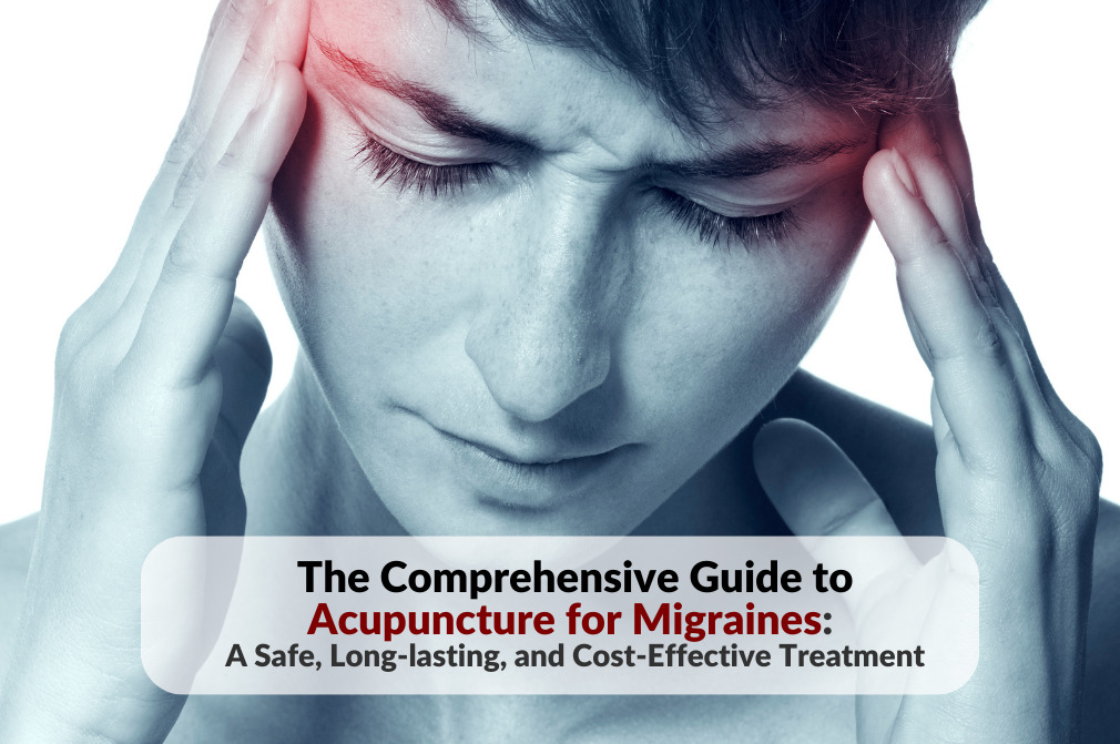 Person clutching their temples in pain, with a blue hue overlay, featuring the article title 'The Comprehensive Guide to Acupuncture for Migraines: A Safe, Long-lasting, and Cost-Effective Treatment'