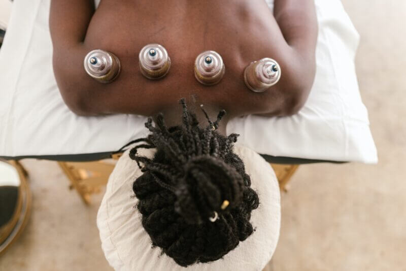 Woman laying facedown on massage table with 4 cupping cups across the top of her back