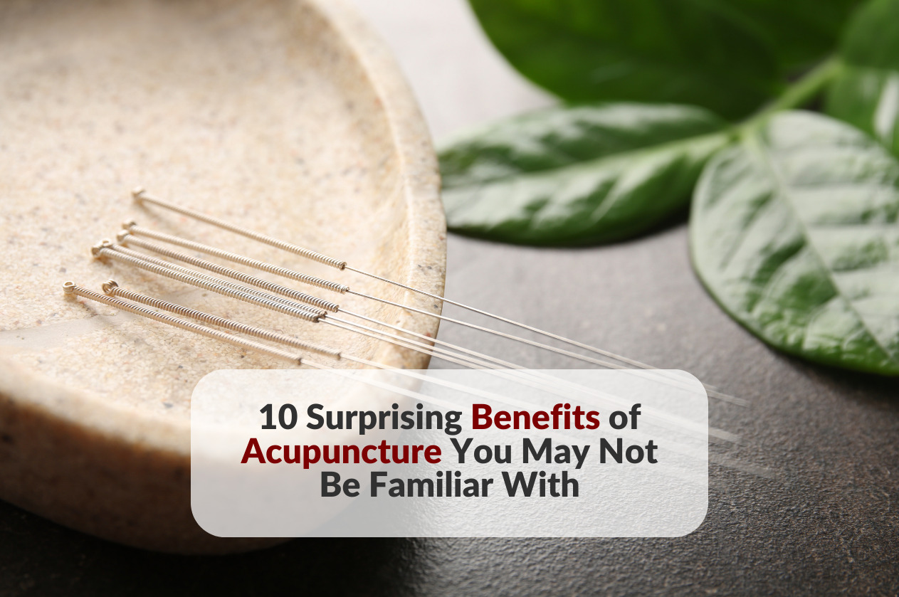 10 Surprising Benefits of Acupuncture You May Not Be Familiar With