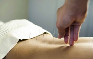 Acupuncture Back Pain
