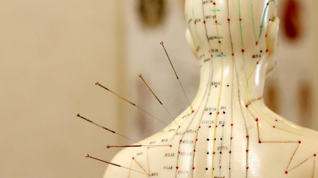 Acupuncture Edmonton