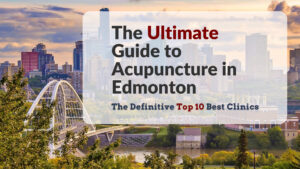 The Ultimate Guide to Acupuncture in Edmonton: The Definitive Top 10 Best Acupuncture Clinics
