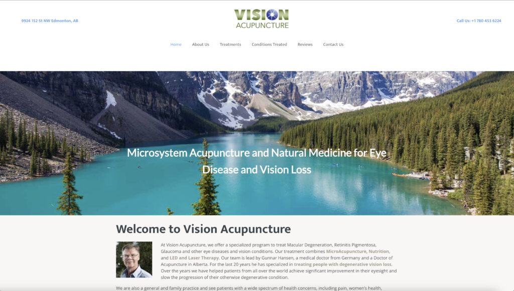 Vision Acupuncture