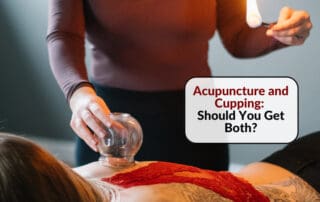 A woman performing an acupuncture and cupping therapy holistic wellness procedure - Red Leaf Wellness Edmonton