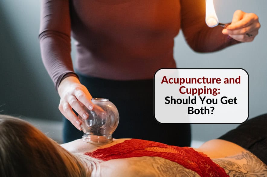 A woman performing an acupuncture and cupping therapy holistic wellness procedure - Red Leaf Wellness Edmonton