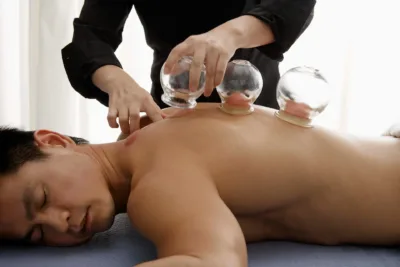 photo - a man getting cupping done, wondring what can naturopaths help with