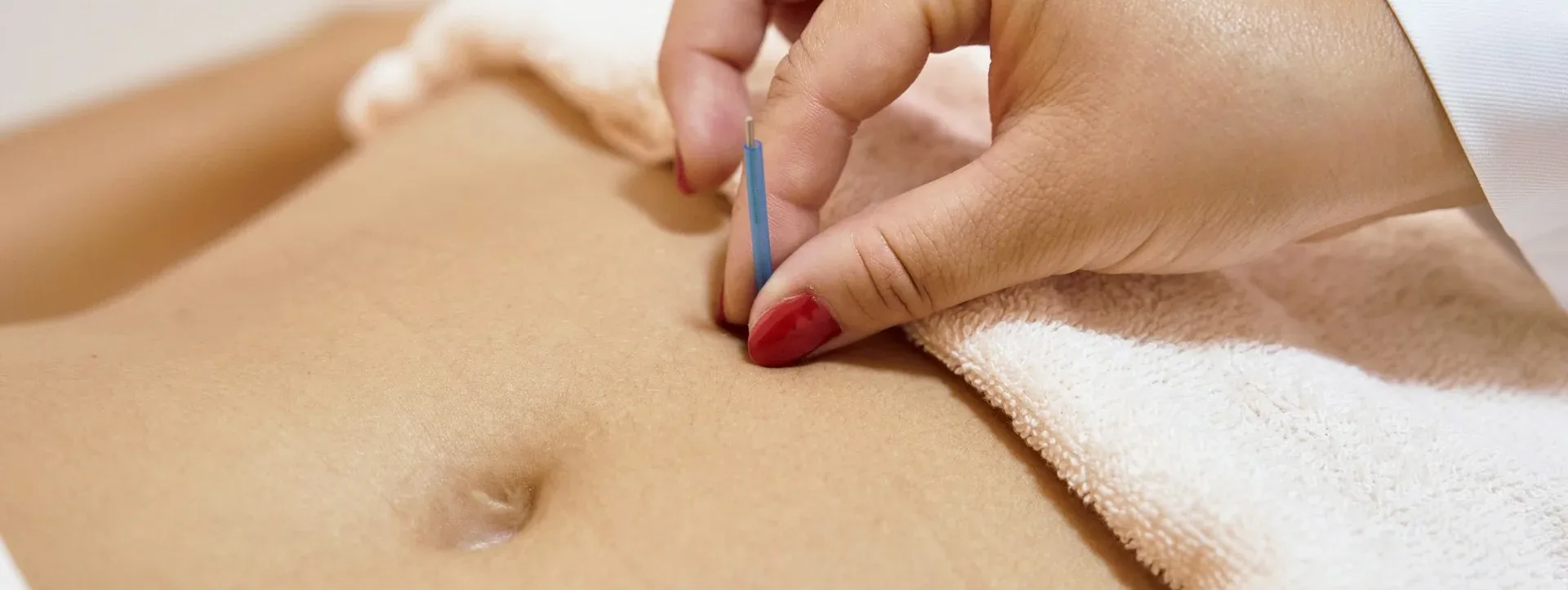 photo - a patient on the massage table and a specialist during an acupunture and cupping session hitting important cupping points for fertility