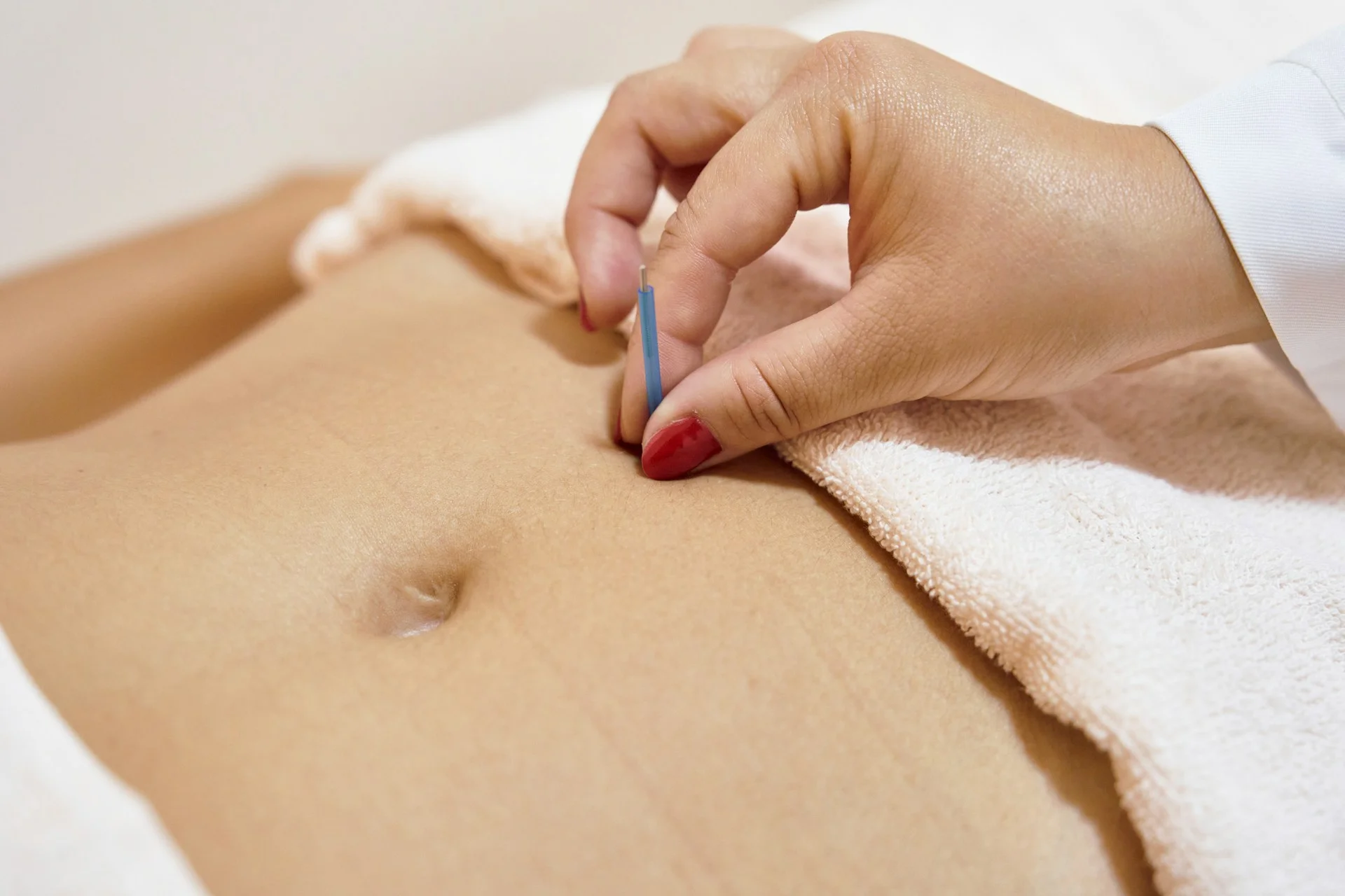 photo - a patient on the massage table and a specialist during an acupunture and cupping session hitting important cupping points