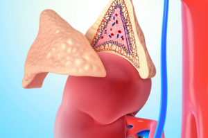 Anatomical illustration of the adrenal gland on the kidney, highlighting its structure and role in hormone production.