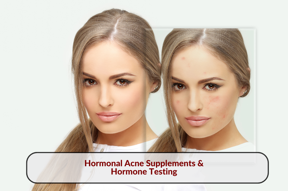 Woman's face showing before and after effects of hormonal acne treatments