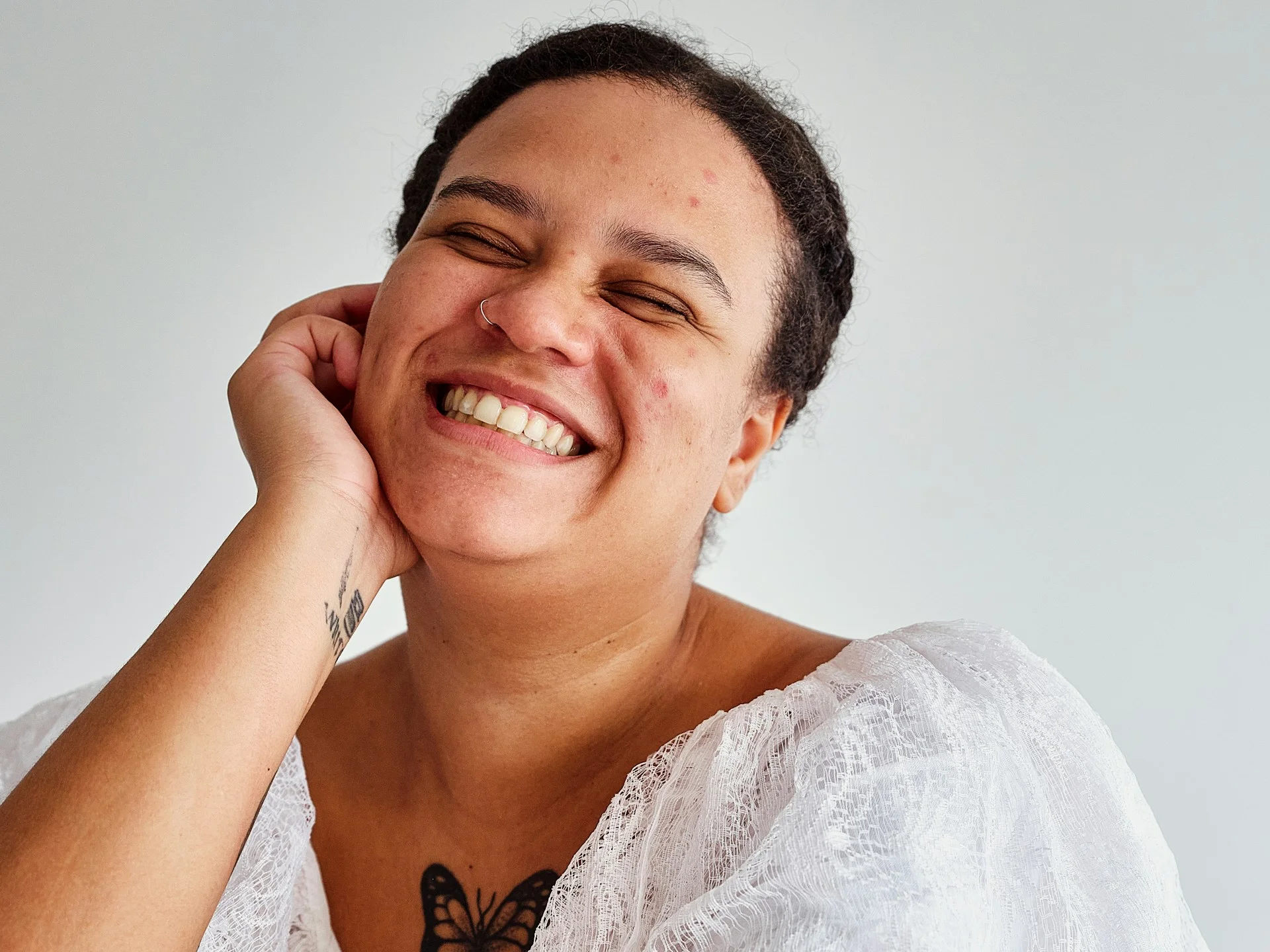 photo - a woman with stubborn acne smiling at the camera 