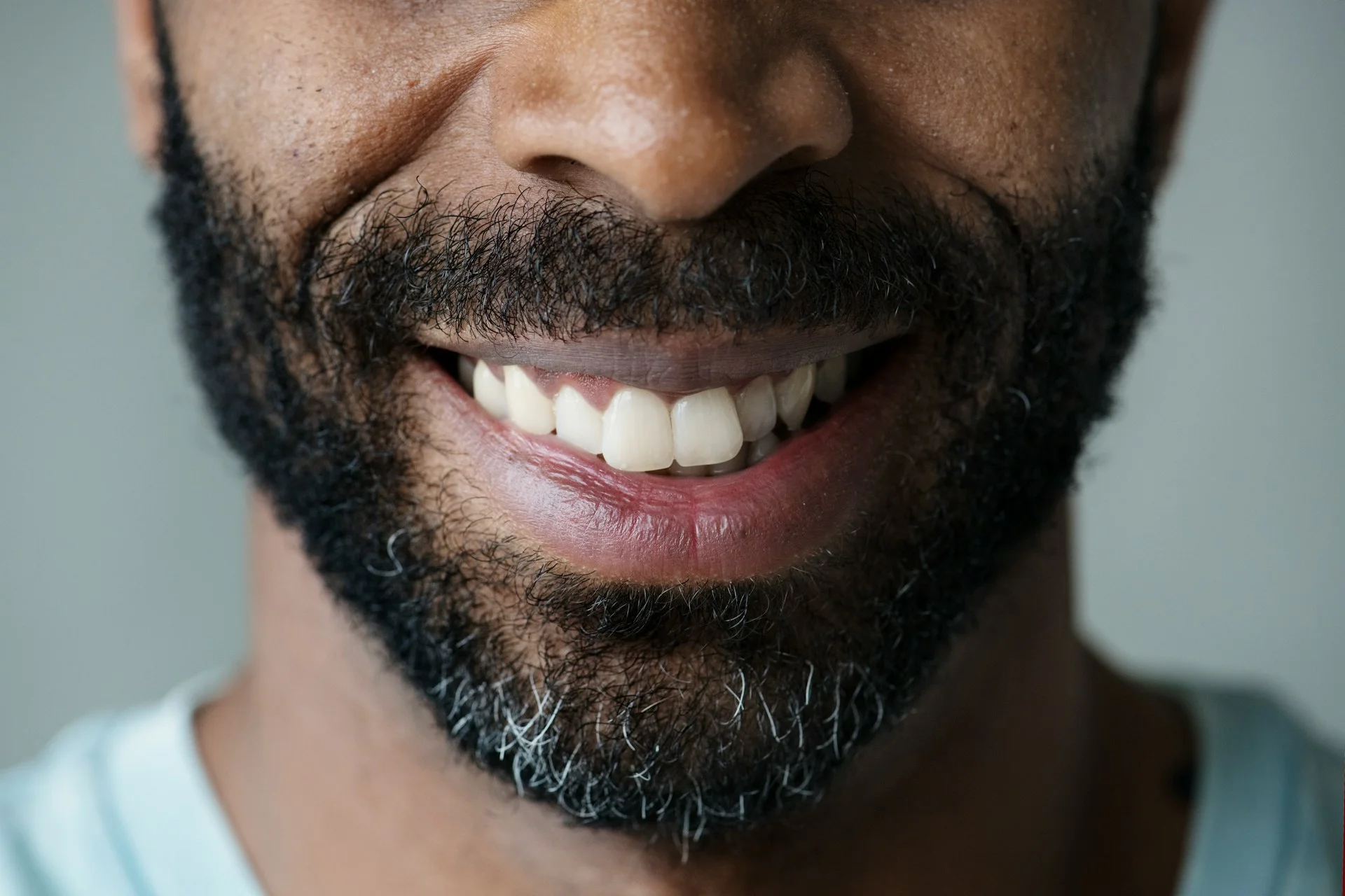 photo a guy smiling before after trt