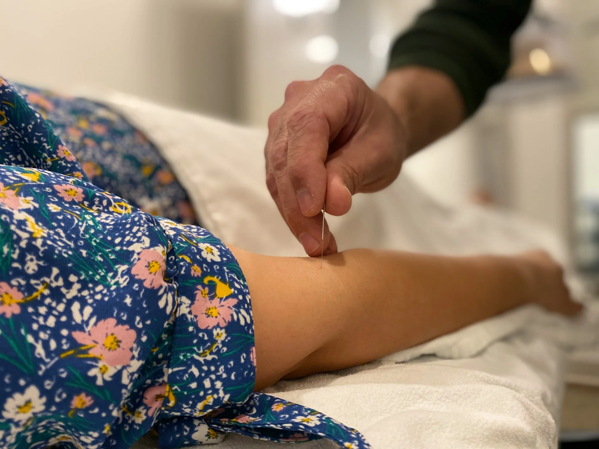 photo a women on an acupuncture appointment after negative side effects of dry needling