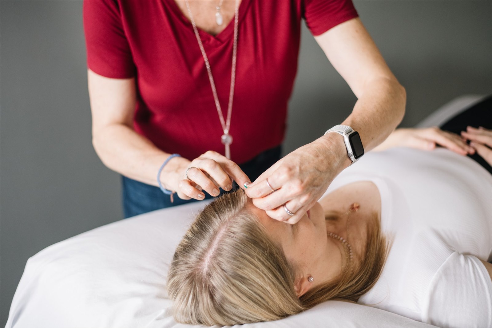 Registered Acupuncturist placing a fine acupuncture needle near a patient's hairline at Red Leaf Wellness in Edmonton.
